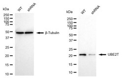 Invitrogen UBE2T Recombinant Rabbit Monoclonal Antibody (24GB2350) 20 &mu;L;