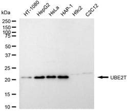 Invitrogen UBE2T Recombinant Rabbit Monoclonal Antibody (24GB2350):Antibodies:Primary