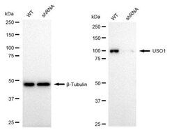 Invitrogen VDP Recombinant Rabbit Monoclonal Antibody (24GB1905) 100 &mu;L;