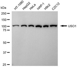 Invitrogen VDP Recombinant Rabbit Monoclonal Antibody (24GB1905) 100 &mu;L;