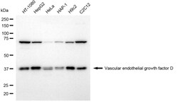 Invitrogen VEGFD Recombinant Rabbit Monoclonal Antibody (24GB1750) 100