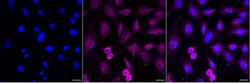 Invitrogen VPS28 Recombinant Rabbit Monoclonal Antibody (24GB1755):Antibodies:Primary