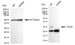 Invitrogen VPS28 Recombinant Rabbit Monoclonal Antibody (24GB1755):Antibodies:Primary