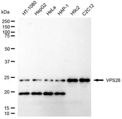 Invitrogen VPS28 Recombinant Rabbit Monoclonal Antibody (24GB1755):Antibodies:Primary