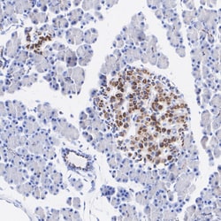 Invitrogen ATF6 Recombinant Rabbit Monoclonal Antibody (PSH06-59) 100 &mu;L;