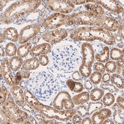 Invitrogen ATF6 Recombinant Rabbit Monoclonal Antibody (PSH06-59) 100 &mu;L;
