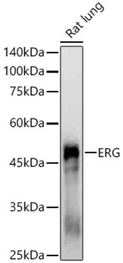 Invitrogen ERG Recombinant Rabbit Monoclonal Antibody (5H6X10):Antibodies:Primary