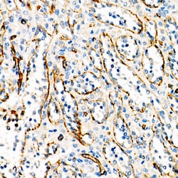Invitrogen VE-cadherin Recombinant Rabbit Monoclonal Antibody (9W5E3):Antibodies:Primary