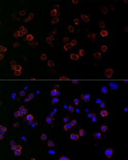 Invitrogen ICAM-1 Recombinant Rabbit Monoclonal Antibody (7A4X3) 20 &mu;L;