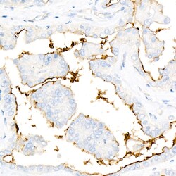 Invitrogen ICAM-1 Recombinant Rabbit Monoclonal Antibody (7A4X3) 20 &mu;L;