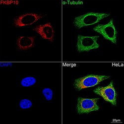 Invitrogen FKBP10 Recombinant Rabbit Monoclonal Antibody (0X3B2):Antibodies:Primary