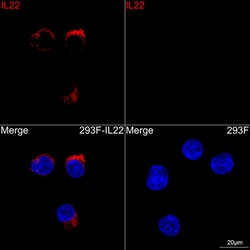 Invitrogen IL-22 Recombinant Rabbit Monoclonal Antibody (4R9J2):Antibodies:Primary