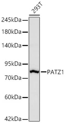 Invitrogen PATZ1 Recombinant Rabbit Monoclonal Antibody (6H7A4) 20 &mu;L;