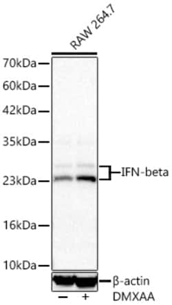 Invitrogen IFN beta Recombinant Rabbit Monoclonal Antibody (6K0L7):Antibodies:Primary