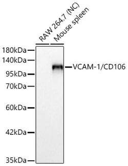 Invitrogen VCAM-1 Recombinant Rabbit Monoclonal Antibody (6I8W2):Antibodies:Primary
