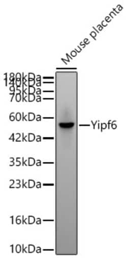 Invitrogen YIPF6 Recombinant Rabbit Monoclonal Antibody (6X1R7) 100 &mu;L;