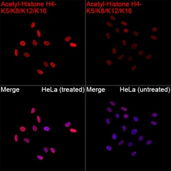 Invitrogen H4ac pan-acetyl (K5,K8,K12,K16) Recombinant Rabbit Monoclonal