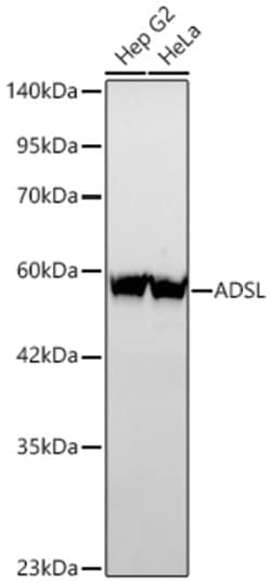 Invitrogen ADSL Recombinant Rabbit Monoclonal Antibody (8J9E10):Antibodies:Primary