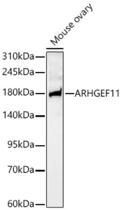 Invitrogen ARHGEF11 Recombinant Rabbit Monoclonal Antibody (1I7H7):Antistoffer:Primære