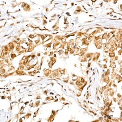 Invitrogen RFWD2 Recombinant Rabbit Monoclonal Antibody (2R8A5):Antibodies:Primary
