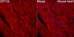 Invitrogen CPT1B Recombinant Rabbit Monoclonal Antibody (0R3Z6):Antibodies:Primary