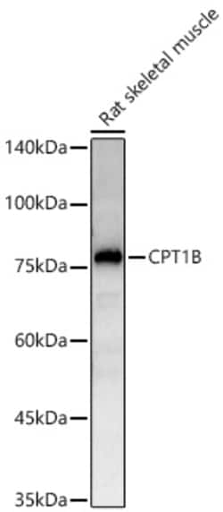 Invitrogen CPT1B Recombinant Rabbit Monoclonal Antibody (0R3Z6) 20 &mu;L;