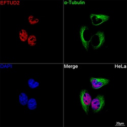 Invitrogen EFTUD2 Recombinant Rabbit Monoclonal Antibody (2Z1K3) 100 &mu;L;