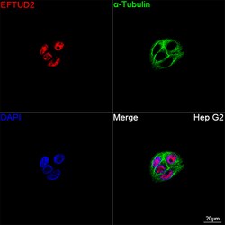 Invitrogen EFTUD2 Recombinant Rabbit Monoclonal Antibody (2Z1K3) 100 &mu;L;