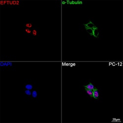 Invitrogen EFTUD2 Recombinant Rabbit Monoclonal Antibody (2Z1K3) 100 &mu;L;