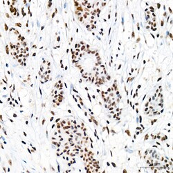 Invitrogen EFTUD2 Recombinant Rabbit Monoclonal Antibody (2Z1K3) 100 &mu;L;