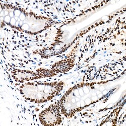 Invitrogen EFTUD2 Recombinant Rabbit Monoclonal Antibody (2Z1K3) 100 &mu;L;