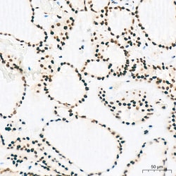 Invitrogen EFTUD2 Recombinant Rabbit Monoclonal Antibody (2Z1K3) 100 &mu;L;