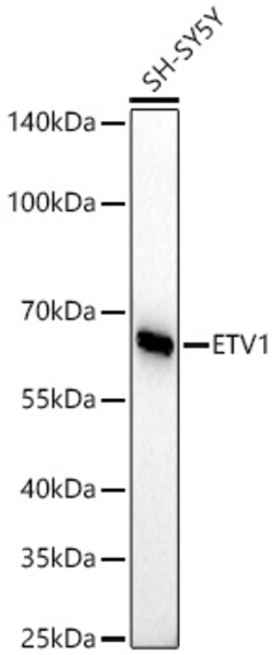 Invitrogen ETV1 Recombinant Rabbit Monoclonal Antibody (8O4N2):Antibodies:Primary