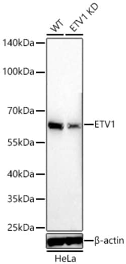 Invitrogen ETV1 Recombinant Rabbit Monoclonal Antibody (8O4N2) 100 &mu;L;