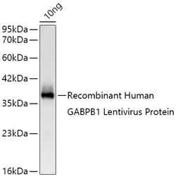 Invitrogen GABPB1 Recombinant Rabbit Monoclonal Antibody (7B5F5):Antibodies:Primary