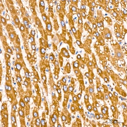 Invitrogen GRP94 Recombinant Rabbit Monoclonal Antibody (7P4V7):Antibodies:Primary