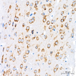 Invitrogen GRP94 Recombinant Rabbit Monoclonal Antibody (7P4V7) 100 &mu;L;