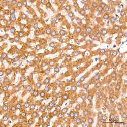 Invitrogen GRP94 Recombinant Rabbit Monoclonal Antibody (7P4V7) 100 &mu;L;