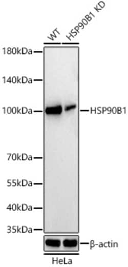 Invitrogen GRP94 Recombinant Rabbit Monoclonal Antibody (7P4V7) 100 &mu;L;
