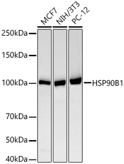 Invitrogen GRP94 Recombinant Rabbit Monoclonal Antibody (7P4V7) 100 &mu;L;