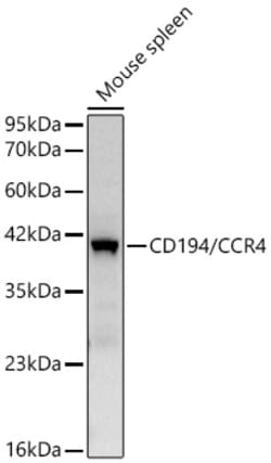 Invitrogen CCR4 Recombinant Rabbit Monoclonal Antibody (5Q9W4):Antibodies:Primary