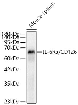 Invitrogen IL-6 Receptor Recombinant Rabbit Monoclonal Antibody (9S8Q5):Antibodies:Primary