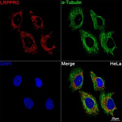 Invitrogen LRP130 Recombinant Rabbit Monoclonal Antibody (2V9I0):Antibodies:Primary