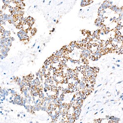 Invitrogen LRP130 Recombinant Rabbit Monoclonal Antibody (2V9I0):Antibodies:Primary