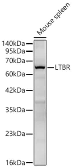 Invitrogen LTBR Recombinant Rabbit Monoclonal Antibody (6D7X5) 20 &mu;L;