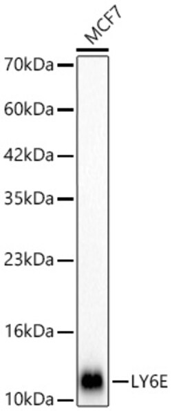 Invitrogen Ly-6E Recombinant Rabbit Monoclonal Antibody (9D8G1):Antibodies:Primary