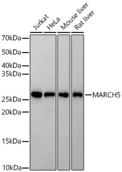 Invitrogen MARCH5 Recombinant Rabbit Monoclonal Antibody (1O4S1) 20 &mu;L;