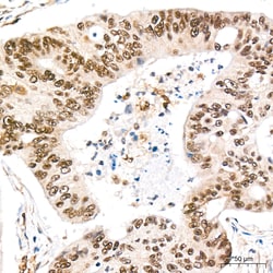 Invitrogen REPIN1 Recombinant Rabbit Monoclonal Antibody (2X2E9) 100 &mu;L;