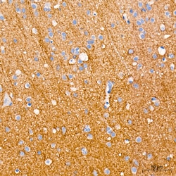 Invitrogen SCN3B Recombinant Rabbit Monoclonal Antibody (5X9J0):Antibodies:Primary