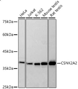 Invitrogen CK2 alpha-2 Recombinant Rabbit Monoclonal Antibody (7T6O9) 20